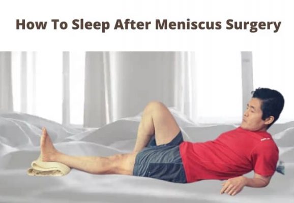 How To Sleep After Meniscus Surgery